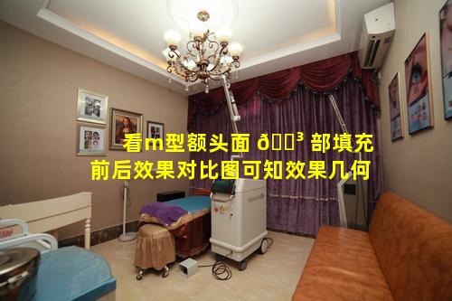 看m型额头面 🌳 部填充前后效果对比图可知效果几何